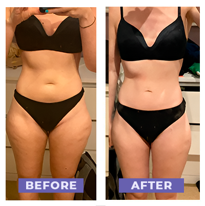 Anti-Cellulite Massager